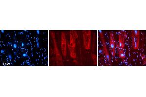 Rabbit Anti-SIRT5 Antibody    Formalin Fixed Paraffin Embedded Tissue: Human Adult heart  Observed Staining: Cytoplasmic Primary Antibody Concentration: 1:600 Secondary Antibody: Donkey anti-Rabbit-Cy2/3 Secondary Antibody Concentration: 1:200 Magnification: 20X Exposure Time: 0. (SIRT5 antibody  (Middle Region))