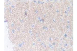 DAB staining on IHC-P; Samples: Rat Cerebrum Tissue (Thrombopoietin antibody  (AA 24-266))