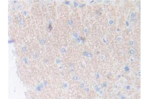 DAB staining on IHC-P; Samples: Rat Cerebrum Tissue (Thrombopoietin antibody  (AA 24-266))