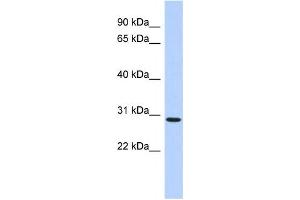 Western Blotting (WB) image for anti-SERTA Domain Containing 2 (SERTAD2) antibody (ABIN2459489)