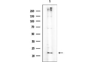 Western blot analysis of lysates from Mouse brain, using UMP/CMP kinase Mouse Monoclonal Antibody at 1/1000 dilution.
