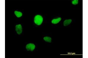 Immunofluorescence of purified MaxPab antibody to ZFP161 on HeLa cell. (ZBTB14/ZFP161 antibody  (AA 1-449))