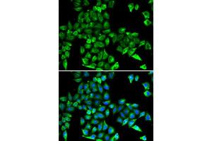 Immunofluorescence analysis of HeLa cells using CST3 antibody (ABIN5970742). (CST3 antibody)