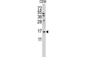 Western Blotting (WB) image for anti-LSM1 Homolog, U6 Small Nuclear RNA Associated (LSM1) antibody (ABIN3001679) (LSM1 antibody)
