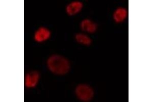 ABIN6275742 staining HepG2 by IF/ICC. (Elf4 antibody  (Internal Region))