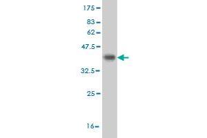Western Blot detection against Immunogen (35. (CDK8 antibody  (AA 375-464))