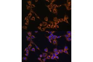 Immunofluorescence analysis of NIH/3T3 cells using R antibody (ABIN6132582, ABIN6146672, ABIN6146673 and ABIN6222096) at dilution of 1:100. (RAMP1 antibody  (AA 27-117))
