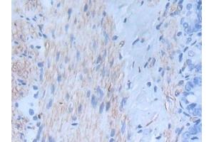 Detection of INHbA in Rat Intestine Tissue using Monoclonal Antibody to Inhibin Beta A (INHbA) (INHBA antibody  (AA 314-424))