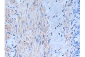 Detection of INHbA in Rat Intestine Tissue using Monoclonal Antibody to Inhibin Beta A (INHbA) (INHBA antibody  (AA 314-424))