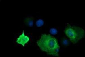 Image no. 2 for anti-Cancer/testis Antigen 1B (CTAG1B) antibody (ABIN1499901) (CTAG1B antibody)