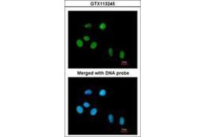 Image no. 2 for anti-Peptidylprolyl Cis/trans Isomerase, NIMA-Interacting 1 (PIN1) (AA 1-133) antibody (ABIN467591) (PIN1 antibody  (AA 1-133))