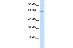 Western Blotting (WB) image for anti-Steroid Sulfatase (Microsomal), Isozyme S (STS) antibody (ABIN2462461) (STS antibody)
