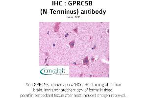 Image no. 1 for anti-G Protein-Coupled Receptor, Family C, Group 5, Member B (GPRC5B) (Extracellular Domain), (N-Term) antibody (ABIN1735216) (GPRC5B antibody  (Extracellular Domain, N-Term))