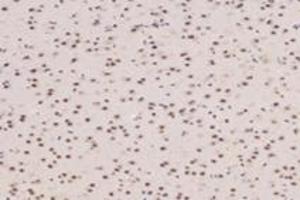 Immunohistochemistry analysis of paraffin-embedded mouse prefrontal lobe using TADA2B (ABIN7075957) at dilution of 1: 3200 (TADA2B antibody)