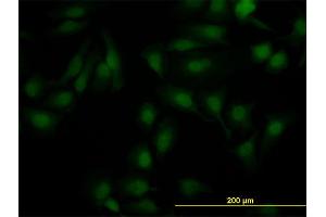 Immunofluorescence of monoclonal antibody to NR1H2 on HeLa cell.