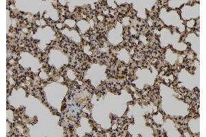 ABIN6279878 at 1/100 staining Mouse lung tissue by IHC-P. (TCEAL2 antibody)
