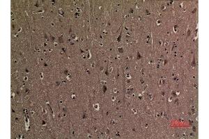 Immunohistochemistry (IHC) analysis of paraffin-embedded Human Brain, antibody was diluted at 1:100. (p53 antibody  (2meLys370))