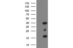 Western Blotting (WB) image for anti-PDZ and LIM Domain 2 (PDLIM2) antibody (ABIN1500124) (PDLIM2 antibody)
