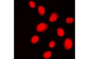 Immunofluorescent analysis of 53BP1 staining in HeLa cells. (TP53BP1 antibody  (N-Term))