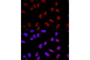 Confocal immunofluorescence analysis of U2OS cells using  Polyclonal Antibody (ABIN3017254, ABIN3017255, ABIN3017256 and ABIN6220015) at dilution of 1:200. (AKAP8 antibody  (AA 480-692))