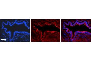 Immunohistochemistry (IHC) image for anti-Proliferation-Associated 2G4, 38kDa (PA2G4) (C-Term) antibody (ABIN2783041)