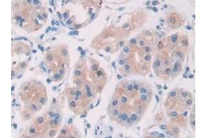Detection of IL28A in Human Stomach Tissue using Monoclonal Antibody to Interleukin 28A (IL28A) (IL28A antibody  (AA 26-200))