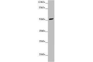 Western blot All lanes: NOXA1 antibody at 2 μg/mL + Mouse brain tissue Secondary Goat polyclonal to rabbit IgG at 1/10000 dilution Predicted band size: 51, 52, 46 kDa Observed band size: 51 kDa (NOXA1 antibody  (AA 150-313))