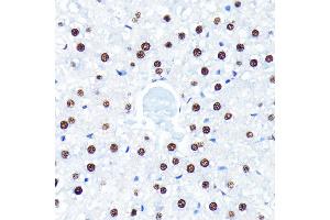 Immunohistochemistry (IHC) image for anti-ELAV (Embryonic Lethal, Abnormal Vision, Drosophila)-Like 1 (Hu Antigen R) (ELAVL1) antibody (ABIN7266913)
