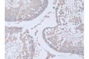 Detection of IFNg in Rat Testis Tissue using Polyclonal Antibody to Interferon Gamma (IFNg) (Interferon gamma antibody  (AA 23-156))