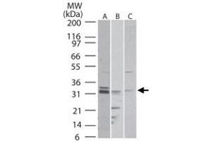 Western blot analysis of RTN4R in A) human, B) mouse and C) rat brain tissue lysate. (RTN4R antibody  (AA 50-100))