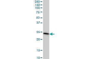 PAFAH1B3 monoclonal antibody (M02), clone 8C11. (PAFAH1B3 antibody  (AA 1-231))