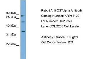 WB Suggested Anti-OSTalpha  Antibody Titration: 0. (OST alpha antibody  (Middle Region))