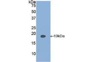 Western blot analysis of recombinant Human PLAA. (PLAA antibody  (AA 162-312))