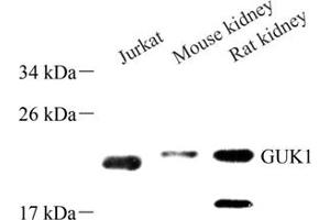 Western blot analysis of GUK1 (ABIN7074153) at dilution of 1: 500 (GUK1 antibody)