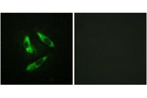 Immunofluorescence analysis of HeLa cells, using Rabphilin 3A (Phospho-Ser237) Antibody. (RPH3A antibody  (pSer237))