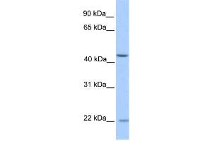 WB Suggested Anti-ZNF485 Antibody Titration:  0. (ZNF485 antibody  (N-Term))