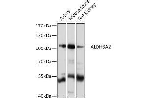 Western blot analysis of extracts of various cell lines, using  Rabbit pAb  at 1:1000 dilution. (ALDH3A2 antibody  (AA 250-320))