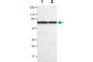 Western Blot analysis of Lane 1: RT-4 and Lane 2: U-251 MG sp cell lysates with BIRC2 polyclonal antibody . (BIRC2 antibody)
