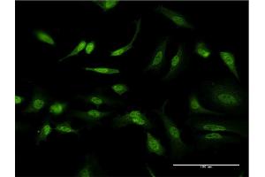 Immunofluorescence of monoclonal antibody to ID1 on HeLa cell. (ID1 antibody  (AA 47-155))