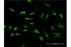 Immunofluorescence of monoclonal antibody to ID1 on HeLa cell.