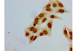 Immunocytochemistry analysis of Hela cells using ABIN7139188 at dilution of 1:100 (HIST1H1E antibody  (acLys51))