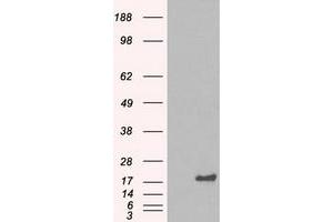 HEK293T cells were transfected with the pCMV6-ENTRY control (Left lane) or pCMV6-ENTRY CRYAB (Right lane) cDNA for 48 hrs and lysed. (CRYAB antibody)