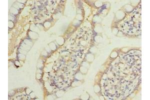 Immunohistochemistry of paraffin-embedded human small intestine tissue using ABIN7158166 at dilution of 1:100 (LRRC39 antibody  (AA 1-335))