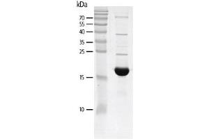 Recombinant TRIM24 (862-980) protein gel. (TRIM24 Protein (AA 862-980) (His tag,DYKDDDDK Tag))