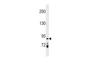 PRICKLE1 Antibody (C-term) (ABIN1537540 and ABIN2850285) western blot analysis in MDA-M cell line lysates (35 μg/lane). (PRICKLE1 antibody  (C-Term))