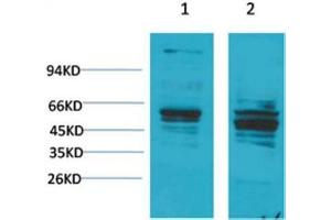 Western Blot (WB) analysis of 1) Mouse Brain Tissue, 2) Rat Brain Tissue with Bombesin Receptor 2 Rabbit Polyclonal Antibody diluted at 1:2000. (Bombesin Receptor 2 antibody)