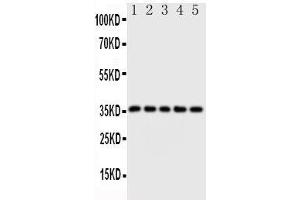 Anti-Fos B antibody, Western blotting Lane 1:  Cell Lysate Lane 2: SW620 Cell Lysate Lane 3: HELA Cell Lysate Lane 4: SMMC Cell Lysate Lane 5: MM453 Cell Lysate