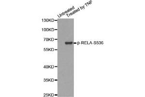 Western blot analysis of extracts from HepG2 cells, using Phospho-RELA-S536 antibody. (NF-kB p65 antibody  (pSer536))