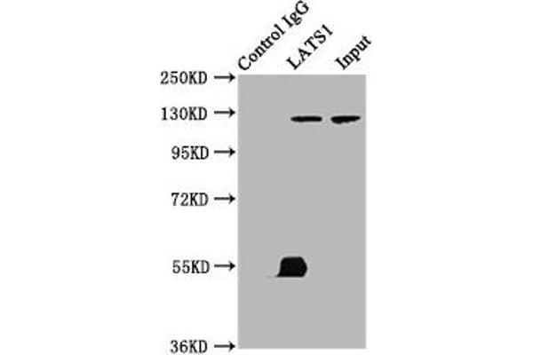 LATS1 antibody  (AA 1-280)