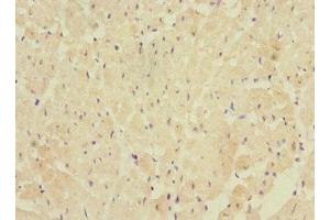 Immunohistochemistry of paraffin-embedded human heart tissue using ABIN7152439 at dilution of 1:100 (FBXO4 antibody  (AA 201-500))